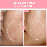 Peptide Acne Serum
