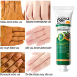 Dark Knuckle Brightening Cream