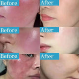Anti-Redness Repair Serum
