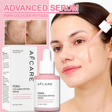 Peptide Acne Serum