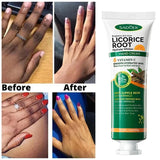 Dark Knuckle Brightening Cream