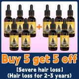 Rapid Hair Growth