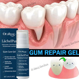 Rapid Gum Repair Gel