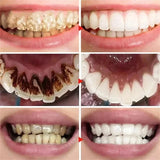 5D Whitening Toothpaste