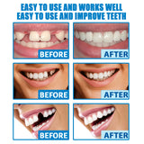 Temporary Tooth Repair Gel