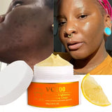 Vitamin C Whitening Kit