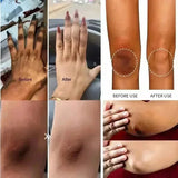 Dark Knuckle Brightening Cream