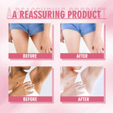 Body Whitening Dark Spot Corrector Cream