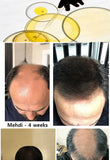 Rapid Hair Growth