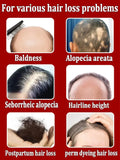 Rapid Hair Growth
