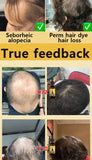 Rapid Hair Growth