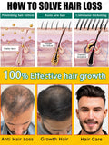 Rapid Hair Growth
