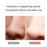 Ultrasonic Skin Scrubber