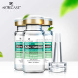 Pimple Control Face Serum Set
