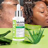 Aloe Vera Lightening Serum