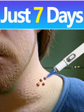 Blue Light Acne Pen