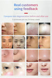 Oxygen Facial Mist Sprayer