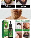 BeardBoost Serum