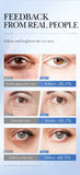 Caviar Eye Bag Removal Cream