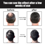 Vitamin E Hair Growth Oil