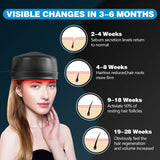 Laser Hair Growth Cap