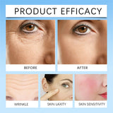 Anti-Redness Repair Serum