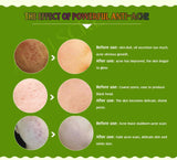 Pimple Control Face Serum Set
