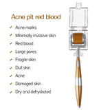ZGTS 192-Needle Derma Roller