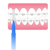 Premium Interdental Dental Picks Set