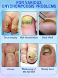 Fast Nail Fungus Repair