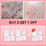 Peptide Acne Serum