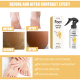 Ouhoe Foot Exfoliating Spray
