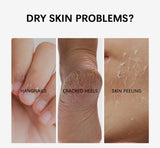 Heel Repair Moisture Stick