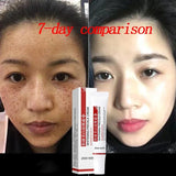 Melasma Brightening Cream