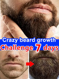 BeardBoost Serum