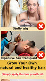 Rapid Hair Growth