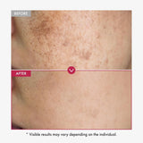 Alpha Arbutin Brightening Serum