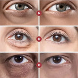 Retinol Anti-Dark Circle Eye Serum