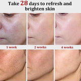 Melasma Brightening Cream