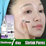 Pore Shrinking Serum